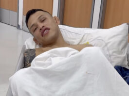 Ronaldo Rodríguez documenta el peso de peso de peso ‘complicaciones’ antes de la señorita, pérdida en UFC México